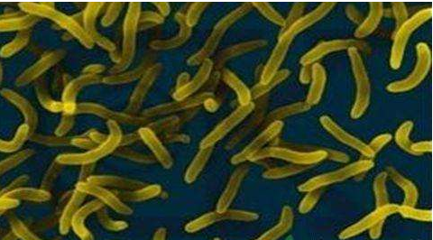 微生物菌劑好？好在哪里您知道嗎？